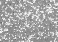 Sprague-Dawley (SD) Fetal Rat Cortex Neurons SCCFN-00001-2