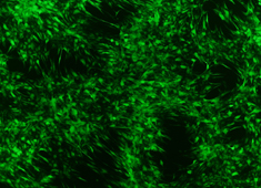 None Human Mesenchymal Stem Cells with GFP HUXMA-01101