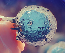 CAR-T 세포 치료 가속화