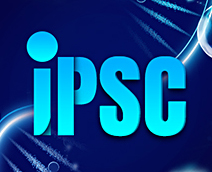 iPSC 질병 모델: CRISPR 편집 및 안정적인 형질감염
