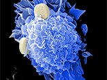 Cancer Cell: 젖산 대사는 종양 미세 환경을 조절함으로써 새로운 면역 요법에 대한 아이디어를 제공한다
