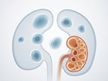 예비 데이터: Inducible PKD 마우스 모델은 3주 만에 표현형을 나타냅니다